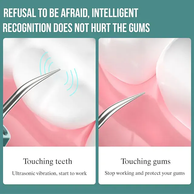 Visual Ultrasonic Teeth Cleaner